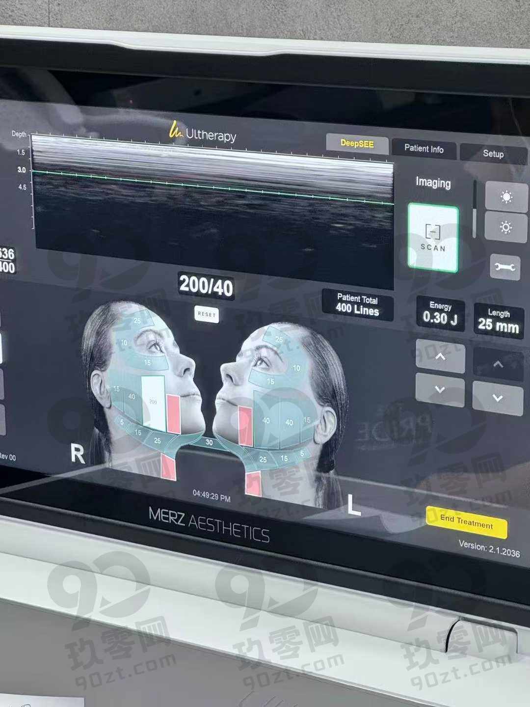 韩国THEPRIDE普爱德整形外科&皮肤科—的热玛吉600发+ONDA脸部8KJ组合:一次解决松垮+下颌线脂肪,为你打造小V脸